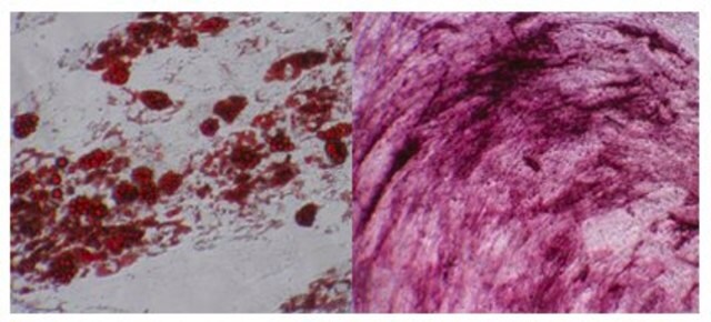 Cellules&nbsp;souches mésenchymateuses humaines (moelle osseuse) Human mesenchymal stem cells derived from bone marrow that have a capacity for expansion in vitro while maintaining their potential for differentiation to multiple lineages including adipocytes, osteoblasts and chondrocytes.