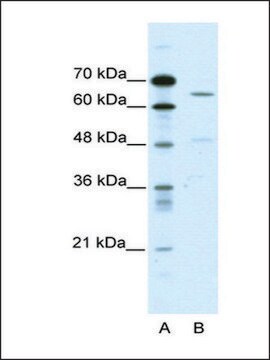 Anti-ACCN1 antibody produced in rabbit affinity isolated antibody