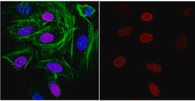 Anticuerpo anti-G-quádruple (G4) de ADN, clon 1H6 clone 1H6, from mouse