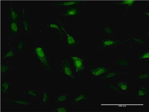 モノクローナル抗SOD1 マウス宿主抗体 clone 10D5, purified immunoglobulin, buffered aqueous solution