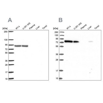 Anti-DYNC1I2 antibody produced in rabbit Prestige Antibodies&#174; Powered by Atlas Antibodies, affinity isolated antibody, buffered aqueous glycerol solution