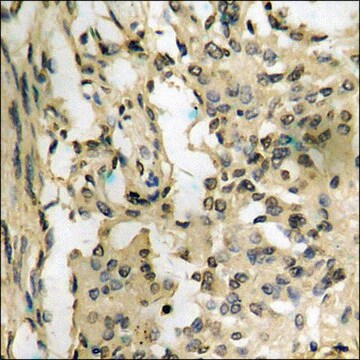 Anti-phospho-p38 MAPK (pTyr182) antibody produced in rabbit affinity isolated antibody