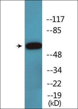 Anti-phospho-Cortactin (pTyr421) antibody produced in rabbit affinity isolated antibody