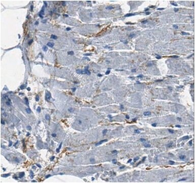 Anti-ANGPTL2 Antibody from rabbit, purified by affinity chromatography