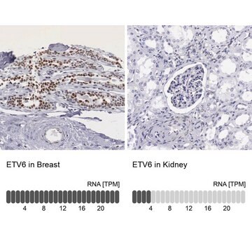 抗ETV6抗体 ウサギ宿主抗体 Prestige Antibodies&#174; Powered by Atlas Antibodies, affinity isolated antibody, buffered aqueous glycerol solution