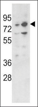 ANTI-PLZF(C-TERMINAL) antibody produced in rabbit purified immunoglobulin, buffered aqueous solution