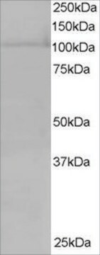 Anti-RANBP16/Ecportin 7 antibody produced in goat affinity isolated antibody, buffered aqueous solution