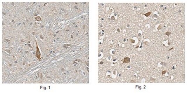 Anticuerpo anti-transportador de colina from rabbit, purified by affinity chromatography