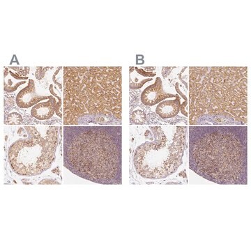 Anti-PGAM5 antibody produced in rabbit Prestige Antibodies&#174; Powered by Atlas Antibodies, affinity isolated antibody, buffered aqueous glycerol solution