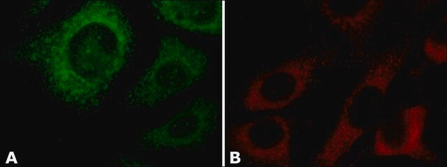 Anti-Cyclophilin B antibody produced in rabbit ~1.0&#160;mg/mL, affinity isolated antibody