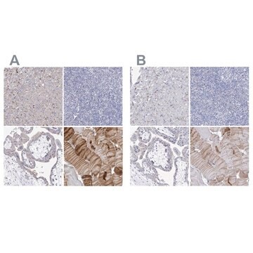 Anti-NRAP antibody produced in rabbit Prestige Antibodies&#174; Powered by Atlas Antibodies, affinity isolated antibody, buffered aqueous glycerol solution