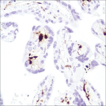 Anti-Coagulation Factor XIII A, Rabbit monoclonal recombinant, expressed in proprietary host, clone SP196, affinity isolated antibody