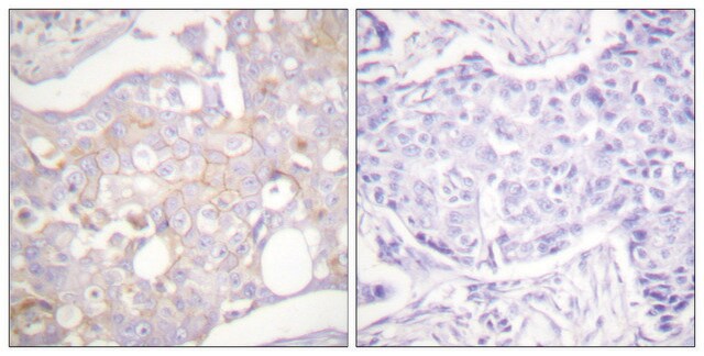 Anti-Claudin 4 antibody produced in rabbit affinity isolated antibody