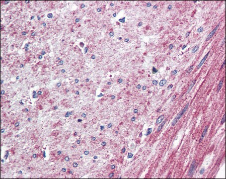 Anti-ELTD1 antibody produced in rabbit affinity isolated antibody