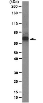 Anti-hnRNP Q-Antikörper, Klon 18E4 clone 18E4, from mouse