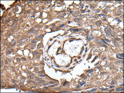 Anti-UBE2D3 affinity isolated antibody