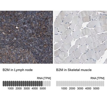 抗-B2M 兔抗 Prestige Antibodies&#174; Powered by Atlas Antibodies, affinity isolated antibody, buffered aqueous glycerol solution