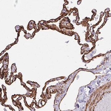 Anti-IGSF23 antibody produced in rabbit Prestige Antibodies&#174; Powered by Atlas Antibodies, affinity isolated antibody, buffered aqueous glycerol solution