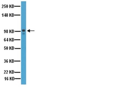 Anticorpo antiMMP-9, domínio catalítico Chemicon&#174;, from rabbit