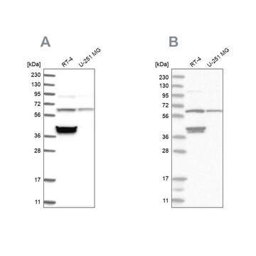 Anti-TCP1 antibody produced in rabbit Prestige Antibodies&#174; Powered by Atlas Antibodies, affinity isolated antibody, buffered aqueous glycerol solution, ab2