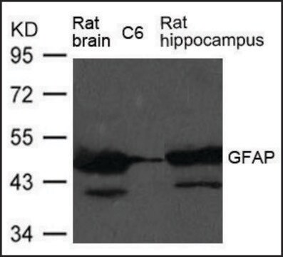 Anti-GFAP antibody produced in rabbit affinity isolated antibody