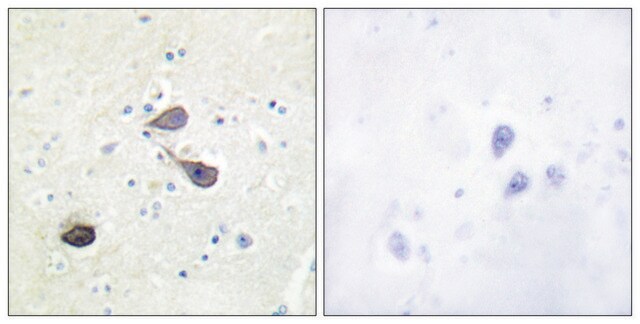 Anti-KOR-1 antibody produced in rabbit affinity isolated antibody