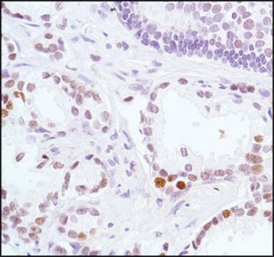 Anti-EZH2 antibody, Rabbit monoclonal clone SP129, recombinant, expressed in proprietary host, affinity isolated antibody