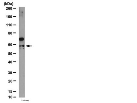 Anti-Cathepsin D Antibody from rabbit, purified by affinity chromatography