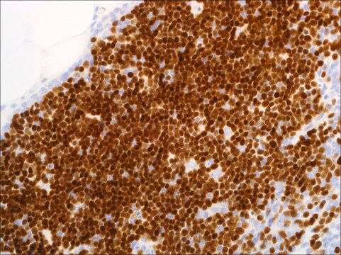 TdT (EP266) Rabbit Monoclonal Primary Antibody