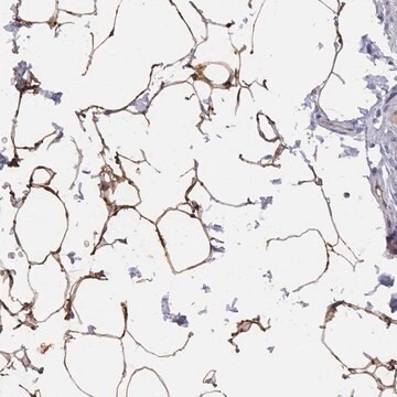 Anti-TUSC5 antibody produced in rabbit Prestige Antibodies&#174; Powered by Atlas Antibodies, affinity isolated antibody, buffered aqueous glycerol solution