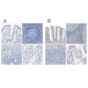 抗SALL4 ウサギ宿主抗体 Prestige Antibodies&#174; Powered by Atlas Antibodies, affinity isolated antibody, buffered aqueous glycerol solution