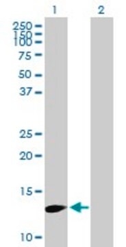 Anti-FBXW9 antibody produced in mouse purified immunoglobulin, buffered aqueous solution