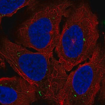 Anti-ADCY7 antibody produced in rabbit Prestige Antibodies&#174; Powered by Atlas Antibodies, affinity isolated antibody