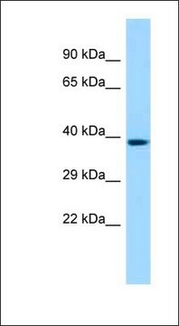 Anti-HCAR2 antibody produced in rabbit affinity isolated antibody