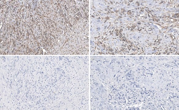 Anti-sACDY10 Antibody, clone R21