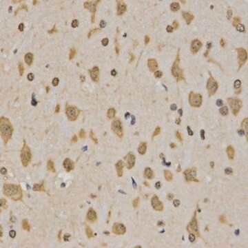 Anti-TriMethyl-Histone H3-K4 antibody produced in rabbit