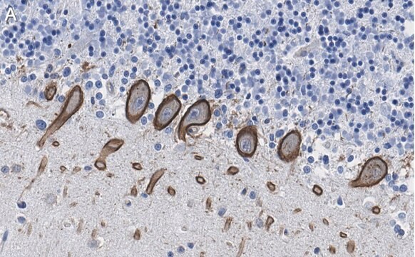 Anti-PKC&#948; Antibody, clone 1C13 ZooMAb&#174; Rabbit Monoclonal recombinant, expressed in HEK 293 cells