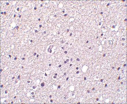 Anti-Neurotrypsin antibody produced in rabbit affinity isolated antibody, buffered aqueous solution