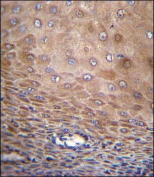 ANTI-TMEM43 (CENTER) antibody produced in rabbit IgG fraction of antiserum, buffered aqueous solution