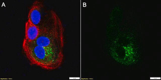 Przeciwciało anty-Trop2, klon 2G10 10889 mysi monoklonalny recombinant, expressed in HEK 293 cells