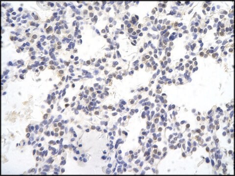 Anti-SMAD4 antibody produced in rabbit affinity isolated antibody