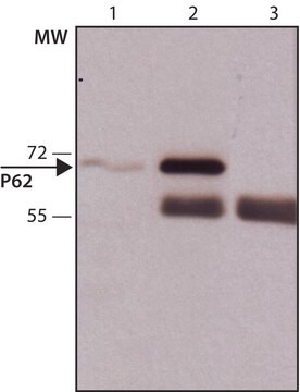 抗p62/SQSTM1 兔抗 ~1&#160;mg/mL, affinity isolated antibody, buffered aqueous solution