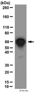 Anti-NF&#954;-p65-Antikörper, CT from rabbit