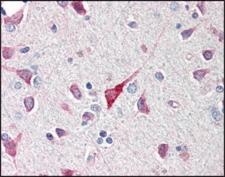 Anti-C1QTNF5 antibody produced in rabbit affinity isolated antibody, buffered aqueous solution