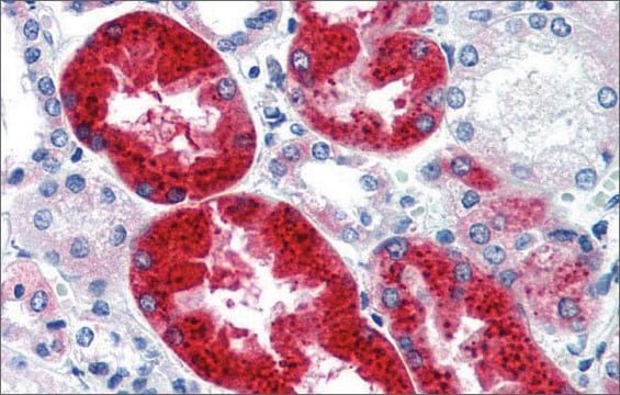 抗EYA1抗体 ウサギ宿主抗体 affinity isolated antibody