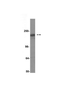 Anticorpo anti-CFTR, clone M3A7 clone M3A7, Upstate&#174;, from mouse