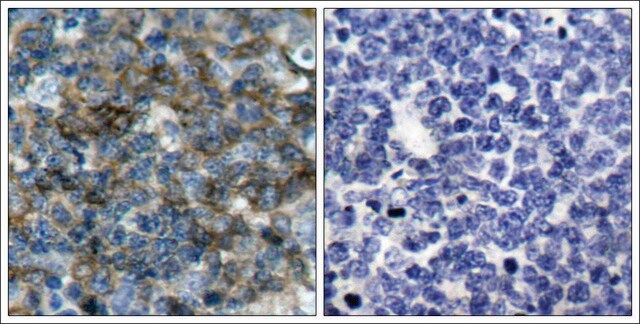 Anti-phospho-VASP (pSer157) antibody produced in rabbit affinity isolated antibody