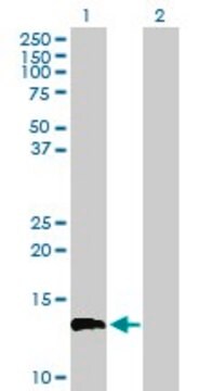 Anti-FLJ39155 antibody produced in mouse purified immunoglobulin, buffered aqueous solution