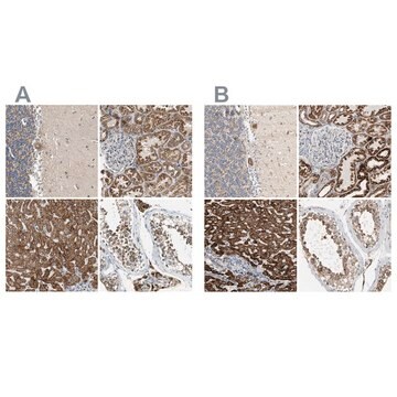 抗ACAT1抗体 ウサギ宿主抗体 Prestige Antibodies&#174; Powered by Atlas Antibodies, affinity isolated antibody, buffered aqueous glycerol solution