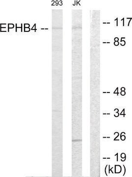 Anti-EPHB4 antibody produced in rabbit affinity isolated antibody